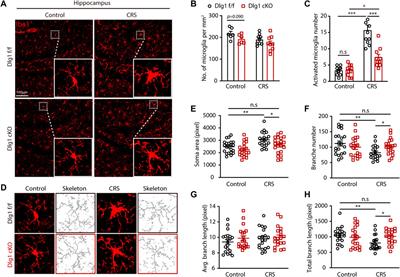 Dlg1 deletion in microglia ameliorates chronic restraint stress induced mice depression-like behavior